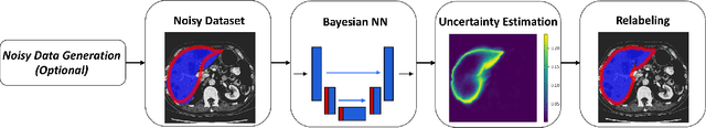 Figure 1 for Uncertainty-based method for improving poorly labeled segmentation datasets