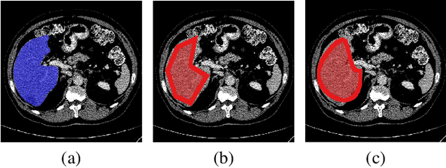 Figure 4 for Uncertainty-based method for improving poorly labeled segmentation datasets