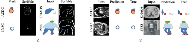 Figure 3 for Self-supervised Multi-scale Consistency for Weakly Supervised Segmentation Learning