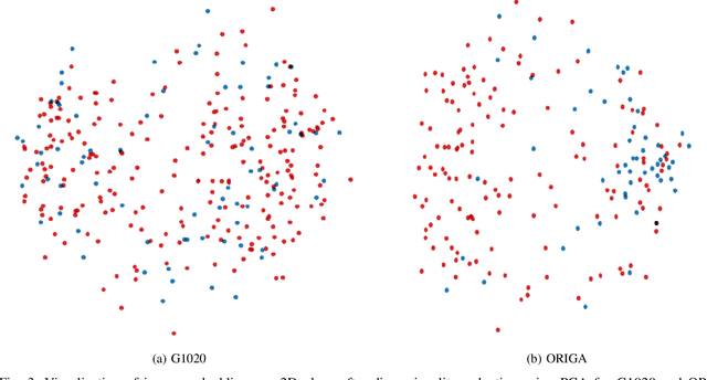 Figure 3 for G1020: A Benchmark Retinal Fundus Image Dataset for Computer-Aided Glaucoma Detection