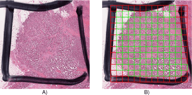 Figure 2 for Assessment of algorithms for mitosis detection in breast cancer histopathology images