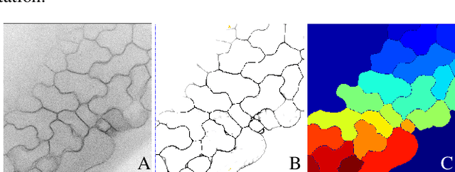 Figure 4 for Accurate 3D Cell Segmentation using Deep Feature and CRF Refinement