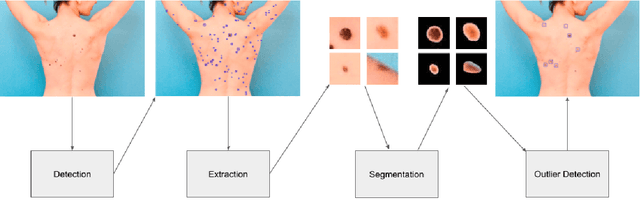 Figure 4 for Can self-training identify suspicious ugly duckling lesions?