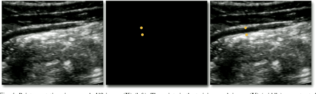Figure 4 for A Deep Learning Localization Method for Measuring Abdominal Muscle Dimensions in Ultrasound Images