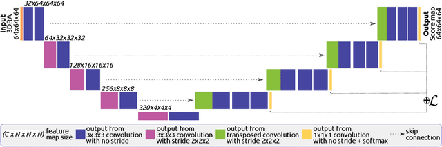 Figure 1 for A deep learning model for brain vessel segmentation in 3DRA with arteriovenous malformations