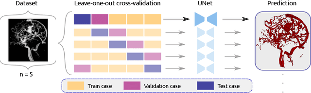 Figure 3 for A deep learning model for brain vessel segmentation in 3DRA with arteriovenous malformations