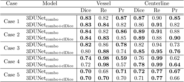 Figure 2 for A deep learning model for brain vessel segmentation in 3DRA with arteriovenous malformations