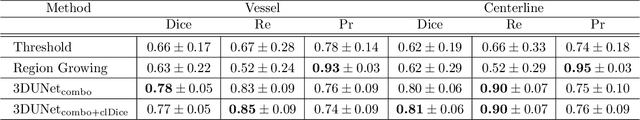 Figure 4 for A deep learning model for brain vessel segmentation in 3DRA with arteriovenous malformations
