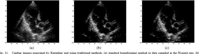 Figure 3 for Compressed Beamforming in Ultrasound Imaging