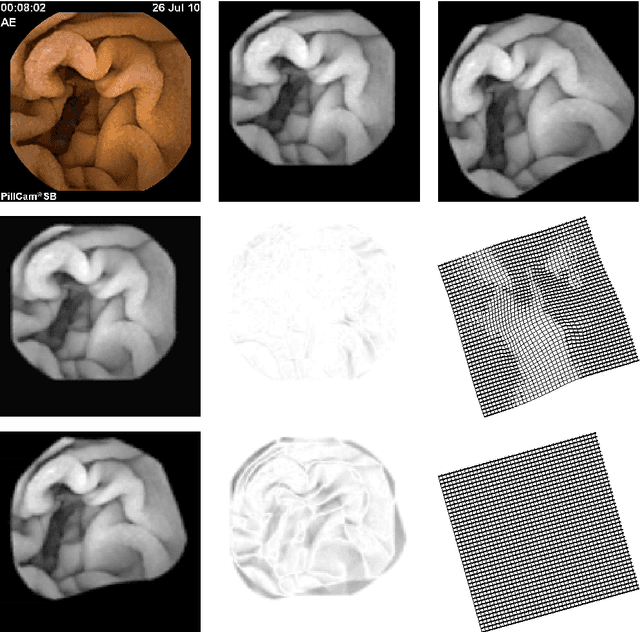 Figure 4 for An Elastic Image Registration Approach for Wireless Capsule Endoscope Localization