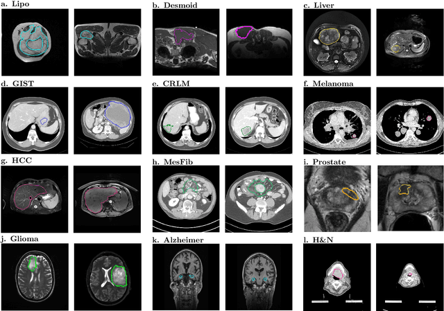 Figure 4 for Reproducible radiomics through automated machine learning validated on twelve clinical applications
