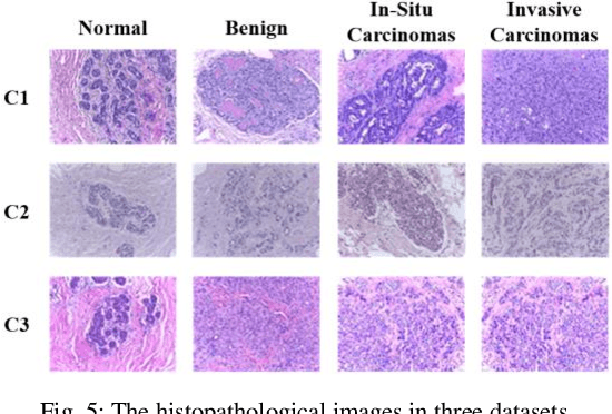 Figure 4 for Pseudo-Data based Self-Supervised Federated Learning for Classification of Histopathological Images