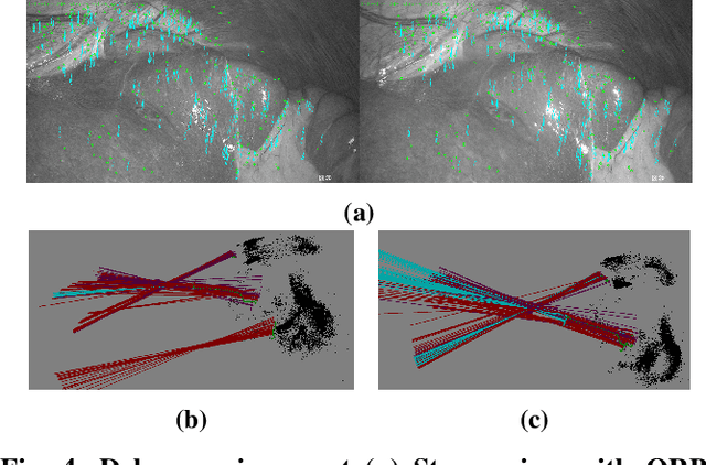 Figure 4 for Constrained Visual-Inertial Localization With Application And Benchmark in Laparoscopic Surgery