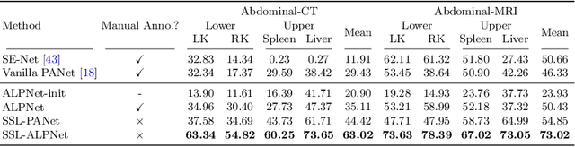Figure 2 for Self-Supervision with Superpixels: Training Few-shot Medical Image Segmentation without Annotation