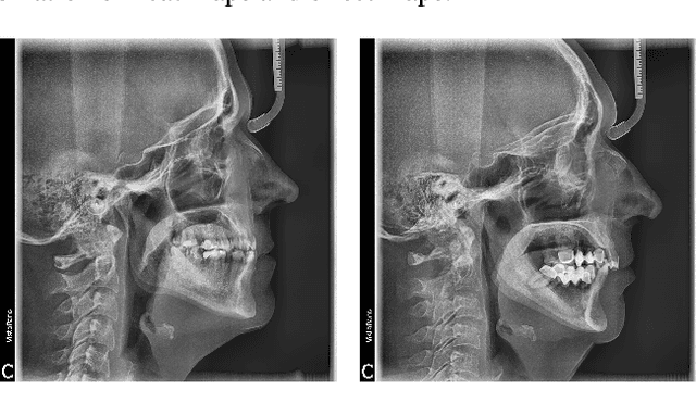 Figure 3 for Convolutional Neural Networks in Orthodontics: a review