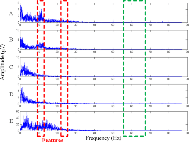 Figure 3 for Effective and Extensible Feature Extraction Method Using Genetic Algorithm-Based Frequency-Domain Feature Search for Epileptic EEG Multi-classification