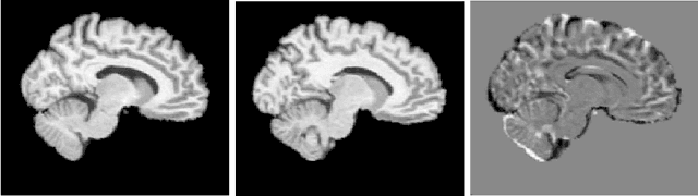 Figure 1 for Efficient Gauss-Newton-Krylov momentum conservation constrained PDE-LDDMM using the band-limited vector field parameterization
