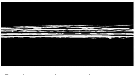Figure 2 for Accurate automatic segmentation of retina layers with emphasis on first layer