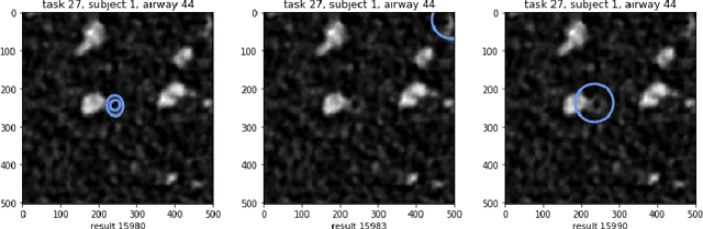 Figure 4 for Crowdsourcing Airway Annotations in Chest Computed Tomography Images