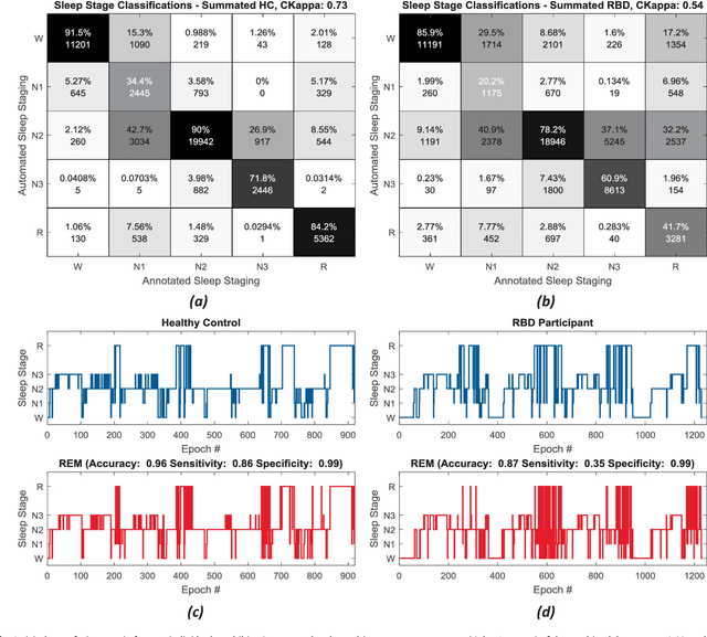 Figure 2 for Detection of REM Sleep Behaviour Disorder by Automated Polysomnography Analysis