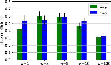 Figure 3 for Reproducible White Matter Tract Segmentation Using 3D U-Net on a Large-scale DTI Dataset