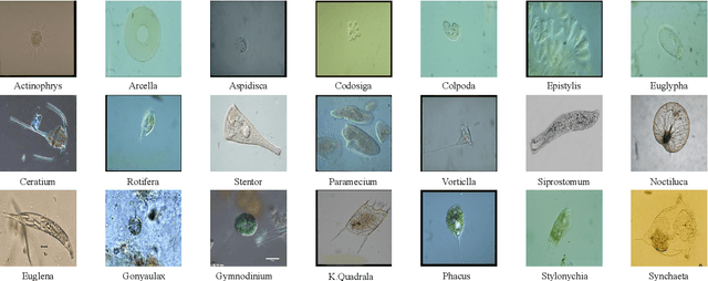 Figure 3 for A Comparison for Patch-level Classification of Deep Learning Methods on Transparent Environmental Microorganism Images: from Convolutional Neural Networks to Visual Transformers