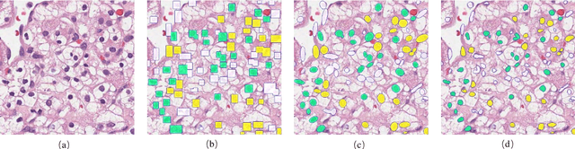 Figure 2 for Effects of annotation granularity in deep learning models for histopathological images