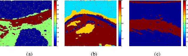 Figure 4 for Joint Segmentation and Deconvolution of Ultrasound Images Using a Hierarchical Bayesian Model based on Generalized Gaussian Priors