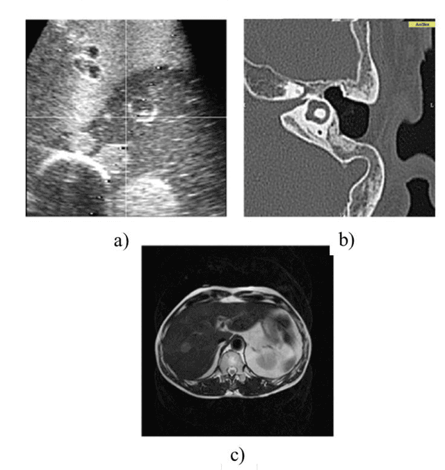 Figure 3 for Advanced Intelligent Systems for Surgical Robotics