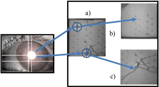 Figure 4 for Advanced Intelligent Systems for Surgical Robotics