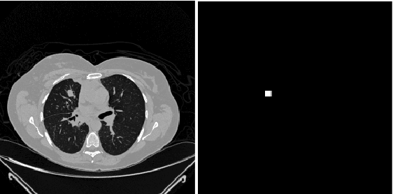 Figure 1 for Transfer Learning by Cascaded Network to identify and classify lung nodules for cancer detection