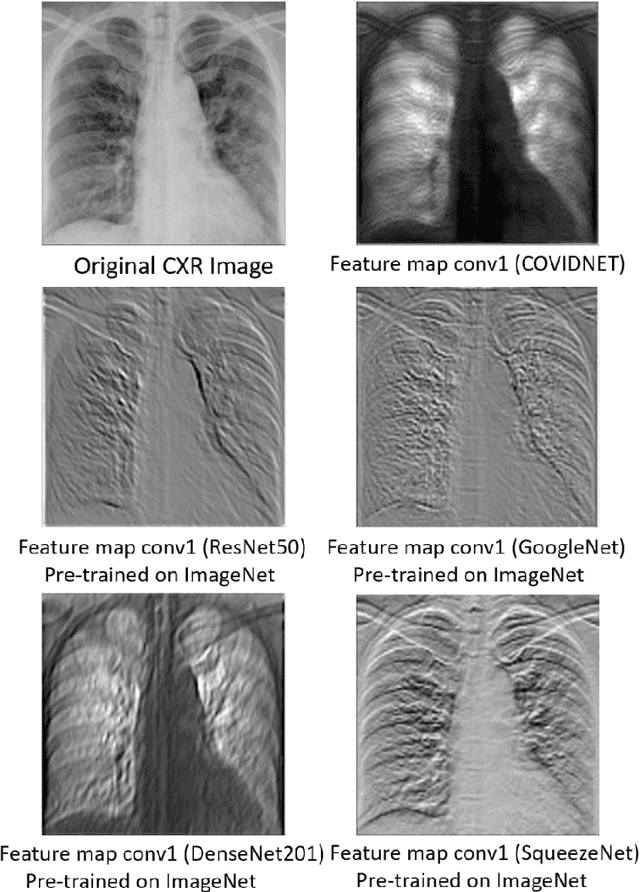 Figure 2 for Triage of Potential COVID-19 Patients from Chest X-ray Images using Hierarchical Convolutional Networks