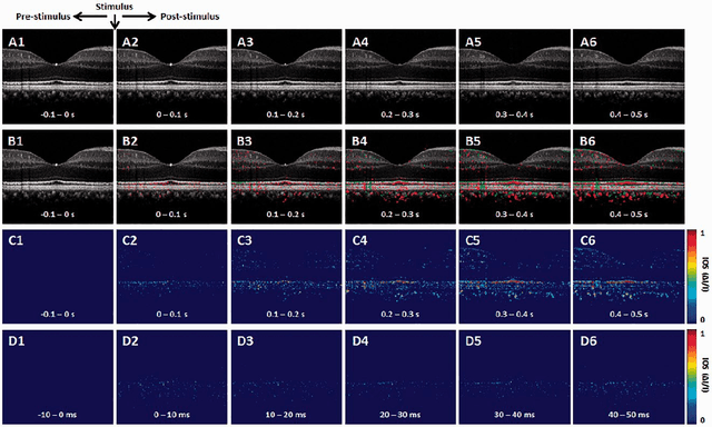 Figure 2 for Functional Optical Coherence Tomography for Intrinsic Signal Optoretinography: Recent Developments and Deployment Challenges