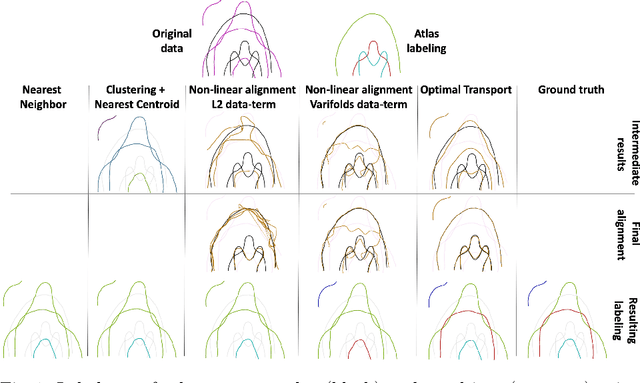 Figure 1 for Fast and Scalable Optimal Transport for Brain Tractograms
