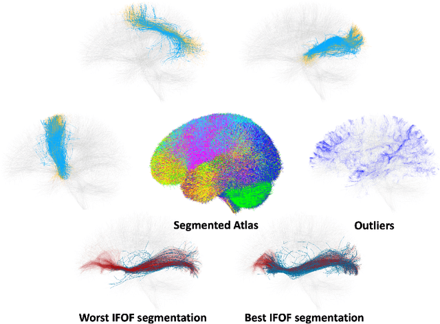 Figure 2 for Fast and Scalable Optimal Transport for Brain Tractograms