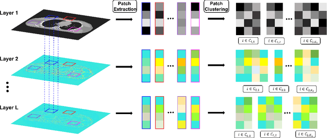 Figure 3 for Multi-layer Clustering-based Residual Sparsifying Transform for Low-dose CT Image Reconstruction