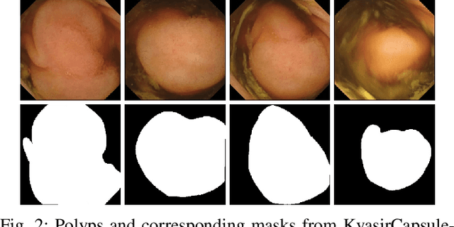 Figure 2 for NanoNet: Real-Time Polyp Segmentation in Video Capsule Endoscopy and Colonoscopy