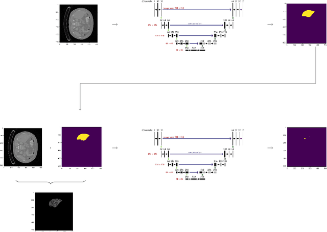 Figure 2 for A Joint Deep Learning Approach for Automated Liver and Tumor Segmentation