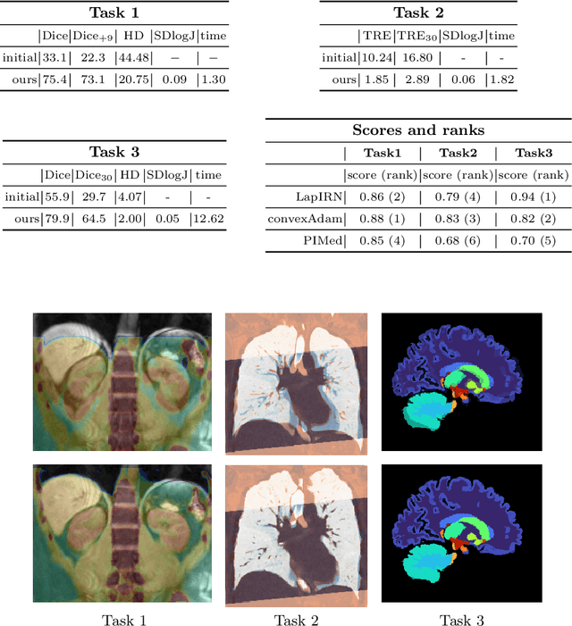 Figure 2 for Fast 3D registration with accurate optimisation and little learning for Learn2Reg 2021
