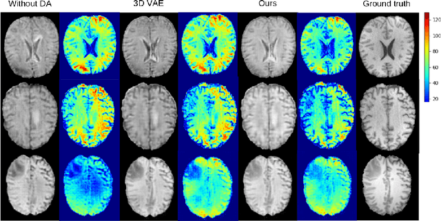Figure 4 for Domain-Adaptive 3D Medical Image Synthesis: An Efficient Unsupervised Approach