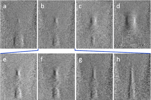 Figure 4 for Ultrasound differential phase contrast using backscattering and the memory effect
