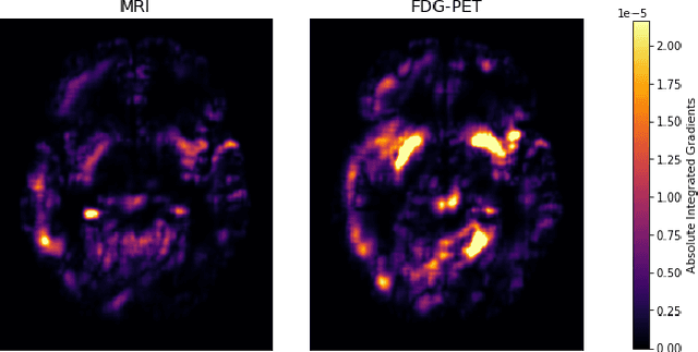 Figure 4 for Is a PET all you need? A multi-modal study for Alzheimer's disease using 3D CNNs