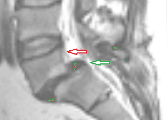 Figure 1 for Cube-Cut: Vertebral Body Segmentation in MRI-Data through Cubic-Shaped Divergences
