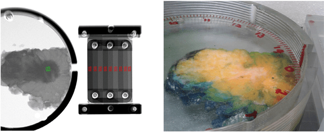 Figure 3 for Measurement of breast-tissue x-ray attenuation by spectral mammography: solid lesions