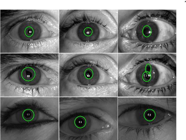 Figure 3 for MTCD: Cataract Detection via Near Infrared Eye Images
