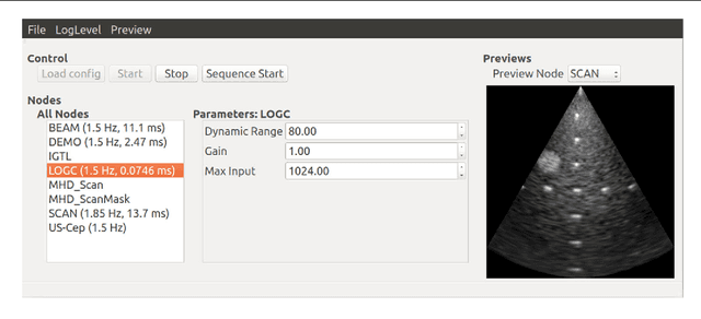Figure 3 for SUPRA: Open Source Software Defined Ultrasound Processing for Real-Time Applications