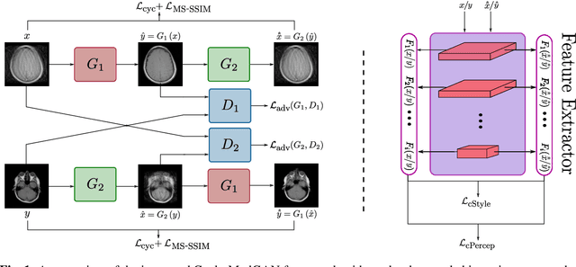 Figure 1 for Unsupervised Adversarial Correction of Rigid MR Motion Artifacts