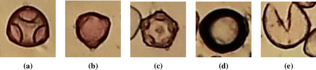 Figure 2 for Pollen13K: A Large Scale Microscope Pollen Grain Image Dataset