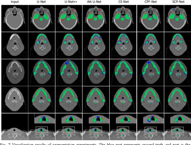 Figure 3 for SECP-Net: SE-Connection Pyramid Network of Organ At Risk Segmentation for Nasopharyngeal Carcinoma