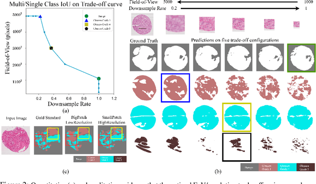 Figure 3 for Foveation for Segmentation of Ultra-High Resolution Images